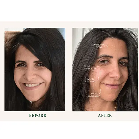 Image 1 and 2, before and after, more radiant, less redness, smoother skin.