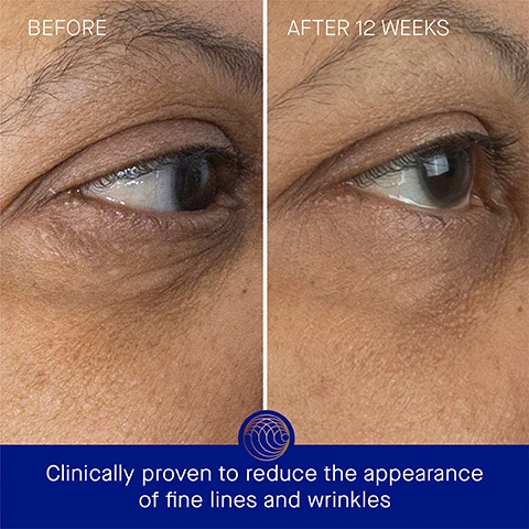 Image 3 - Image shows a side-by-side comparison of the eye area of a person, labeled Before on the left and After 12 Weeks on the right, with visible text stating Clinically proven to reduce the appearance of fine lines and wrinkles.
Image 4 - Before and after images of a persons eyes showing improvement in skin texture and dark circles, with visible text reading BEFORE on the left and AFTER 12 WEEKS on the right, along with text below stating Clinically proven to reduce the appearance of dark circles and increase luminosity.
Image 5 - A golden skincare bottle with a pump sits on a light surface, casting a shadow, next to text that states Clinically Proven Results, The appearance of fine lines are reduced by 57%, Skin hydration is improved by over 3x, Skin luminosity is improved by 2.9x, and includes a note about a clinical trial.
Image 6 - Image of a golden eye cream bottle on a blue background with the text User Proven Results at the top, followed by three statements about the products effectiveness: 99% agree tired eyes look refreshed, luminous and well-rested, 99% agree the eye area appears more youthful, tighter and less crepey, and 95% agree crow’s feet look noticeably reduced, along with a small note at the bottom about a consumer perception study.
Image 7 - A dark blue bottle with a copper top is set against a blurred blue background, with text around it listing key ingredients: TFC8® A proprietary technology that creates the optimal environment for skin cellular renewal, Arjun Tree Extract Helps firm and combat signs of aging, Duo of Seaweed Extracts Minimizes the appearance of puffiness and dark circles, Vitamin C Supports collagen production and brightens complexion.
Image 8 - Image shows a step-by-step skincare application guide with three images: the first shows a hand dispensing product onto fingers; the second shows a woman gently tapping cream around her eyes; and the third shows her smoothing the product into her skin, with visible text for each step reading Step 1: Dispense 1 pump onto fingertips or back of hand, Step 2: Gently tap in a semi-circle around the eyes, starting at the inner corner from the nose, to the outer corner, then sweeping underneath the brow bone, and Step 3: Continue this motion to smooth into the skin until fully absorbed.
Image 9 - Image features two skincare products side by side: on the left, a lightweight eye cream in an orange bottle labeled The Eye Cream with benefits of hydrating and illuminating, ideal for combination to oily skin; on the right, a rich eye cream in a blue jar labeled The Rich Eye Cream with benefits of lifting and firming, ideal for combination to very dry or aging skin.
Image 10 - Image of a skincare routine with five labeled products, including: 1. Cleanse - THE CREAM CLEANSING GEL, 2. Tone & Exfoliate - THE ESSENCE, 3. Correct & Illuminate - THE SERUM, 4. Balance & Hydrate - THE LIGHT CREAM, 5. Revitalize & Refresh - THE EYE CREAM.
Image 11 - A gold and blue skincare product duo featuring a golden cylindrical container labeled Augustinus Bader and a blue bottle with a gold cap also labeled Augustinus Bader, with visible text indicating 15 ml Refill and 15 ml.