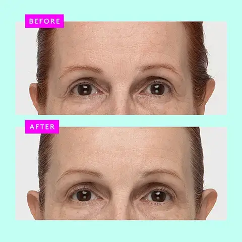 Image 1, BEFORE AFTER Image 2, 96% showed improvement in skin's tone, radiance, and luminosity' 93% showed improvement in texture* 90% showed improvement in skin's hydration' *In a consumer-perception study with 32 people after 8 weeks of use Protini Polypeptide Cream Crème aux polypeptides STRENGTHEN MOISTURIZE 50 Image 3, signal peptide complex binds moisture to skin plumping firming and restoring bounce pygmy waterlily stem cell extract source of antioxidants and nutrients to replenish the skin soybean folic acid ferment extract plays a central role in maintaining youthful elastic skin Image 4, FACE-OFF MOISTURIZER EDITION Procini Polypeptide Cream Creme aux polypeptides ProtiniTM Polypeptide Cream KEY INGREDIENTS 9 Signal Peptides + Pygmy Waterlily Perfect for anyone looking to moisturize and firm skin with a lightweight, gel-cream texture ANYTIME (DAY OR NIGHT) Lala Retro" Whipped Cream Crème fouettée Lala RetroTM Whipped Cream KEY INGREDIENTS African-Oil Blend + Ceramides Perfect for anyone in need of barrier- supportive moisture and replenishment who loves a rich, whipped texture ANYTIME (DAY OR NIGHT)Image 5, own your power smoothie for firmer, hydrated, younger-looking skin 1 PUMP Protini Cream 1 PUMP B-Hydra 1 PUMP Protini Serum Mix it all together and apply.