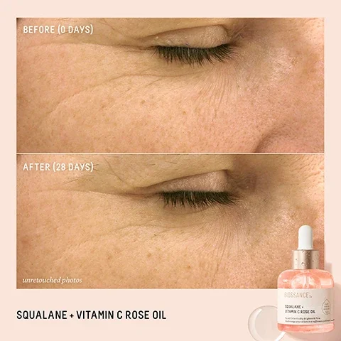 before and after 28 days. unretouched photos. squalane and vitamin c rose oil.