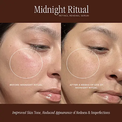 Image 1, midnight ritual retinol renewal serum before and after 4 weeks use of midnight ritual, improved skin tone, reduced appearance of redness and imperfections. Image 2, midnight ritual retinol renewal serum before and after 4 weeks use of midnight ritual, reduced appearance of fine lines and wrinkles. Image 3, midnight ritual retinol renewal serum before and after 4 weeks use of midnight ritual, improved skin tones, reduced appearance of redness and imperfections. Image 4, midnight ritual retinol renewal serum before and after 4 weeks use of midnight ritual, improved skin stone, reduced appearance of redness and imperfections. Image 5, midnight ritual retinol renewal serum, 97% ahreed their skin has a visibly smoother texure, 94% agreed their skin feels soothed and calmed, 91% showed an improvement in facial skin redness. in an independent consumer use study with 33 participants ranging in age from 31-60, after 4 weeks of use. in an independent clinical study of 33 participants ranging in age from 31-60, after 4 weeks of use.