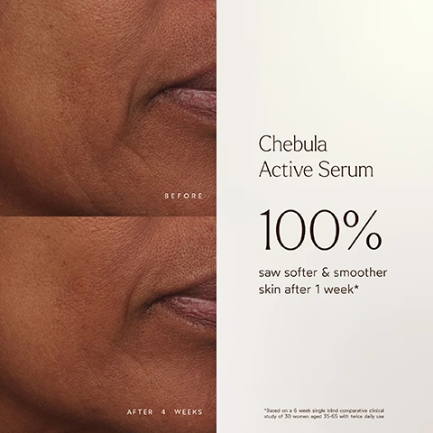 Image 1 - A close-up of a persons cheek showing two images labeled Before at the top and After 4 Weeks at the bottom, with text that reads Chebula Active Serum and 100% saw softer & smoother skin after 1 week*.
Image 10 - Image shows information about True Botanicals MADE SAFE certification, highlighting banned ingredients such as Sodium Lauryl Sulfate, Phthalates, and Silicones, along with various certifications like EWG Certified and Vegan & Cruelty-Free.
Image 2 - Image shows a split-screen comparison of an eye area with Before on the left and After 4 Weeks on the right, indicating visible improvement; text at the bottom states 97% SAW A REDUCTION in the look of fine lines & wrinkles after 4 weeks* followed by a note about a clinical study.
Image 3 - A split image showing a womans face with a before photo on the left side displaying visible fine lines and wrinkles and an after photo on the right side indicating smoother skin; text at the top reads Chebula Active Serum, and below it states 97% SAW A REDUCTION in the look of fine lines & wrinkles after 4 weeks.
Image 4 - Image shows a split view of a womans face with the left side labeled Before displaying blemishes and the right side labeled After 4 Weeks showing smoother skin; text at the bottom states 87% EXPERIENCED MORE even skin tone after 1 week* and includes a note about a clinical study.
Image 5 - Image shows a side-by-side comparison of a womans face before and after using Chebula Active Serum, with her on the left having noticeable redness and uneven skin tone, and on the right displaying a smoother, clearer complexion; visible text includes Chebula Active Serum, Before and After, as well as a testimonial stating This made my super soft skin return and now I’m obsessed alongside the name Manndie T.
Image 6 - An image of a dark glass dropper bottle labeled True Botanicals Chebula Active Serum surrounded by green leaves, with text stating 100% tested saw softer and smoother skin, 100% tested saw a reduction in the look of fine lines and wrinkles, 100% said skin looks more vibrant after 1 week, and 100% said skin instantly feels more hydrated after just 1 use.
Image 7 - A product advertisement for Chebula Active Serum highlighting that it is the #1 Best Selling Anti-Aging Serum, with a list of benefits including diminishing fine lines and wrinkles, restoring firmness, evening skin tone, softening roughness, brightening dull skin, being hypoallergenic, and pregnancy safe.
Image 8 - A brown glass dropper bottle labeled Chebula Active Serum is surrounded by green leaves, a small icy droplet, and black elderberries, with text describing the benefits of Chebula, Hyaluronic Acid, and Elderberry.
Image 9 - An arrangement of skincare products from True Botanicals, including Nourishing Cleanser, Chebula Active Serum, Renew Pure Radiance Oil, and Chebula Extreme Cream, with the text SHOP OUR Best-Selling Routine and numbered steps for cleansing, treating, nourishing, and moisturizing.