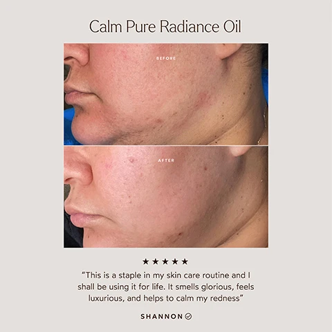 Image 1 - Before and after comparison of a persons face showing improvement in skin texture, with visible text stating Calm Pure Radiance Oil at the top, BEFORE and AFTER labels, and a review quote below that reads This is a staple in my skin care routine and I shall be using it for life. It smells glorious, feels luxurious, and helps to calm my redness, signed SHANNON.
Image 2 - An image of a light orange circular surface with the text CALM PURE RADIANCE OIL Soothe & Comfort Sensitive Skin followed by a checklist of features including deeply moisturizing, targets signs of aging, smooths fine lines & wrinkles, soothes and calms redness & irritation, dermatologically tested, hypoallergenic, and pregnancy safe, along with several certification icons.
Image 3 - A bottle of True Botanicals Pure Radiance Oil is placed centrally among yellow flowers, slices of cucumber, and ginger root, with text indicating the benefits of Ginger Root Oil, Calendula Oil, and Cucumber Seed Oil.
Image 4 - Three bottles of facial oils are displayed: Renew Pure Radiance Oil, Clear Pure Radiance Oil, and Calm Pure Radiance Oil, with text that reads Which Oil is Right for You? followed by descriptions of each oils benefits.
Image 5 - An infographic promoting True Botanicals products, stating they are certified MADE SAFE, highlighting banned ingredients such as Sodium Lauryl Sulfate and parabens, and listing certifications like Dermatologist Tested and EWG Certified.