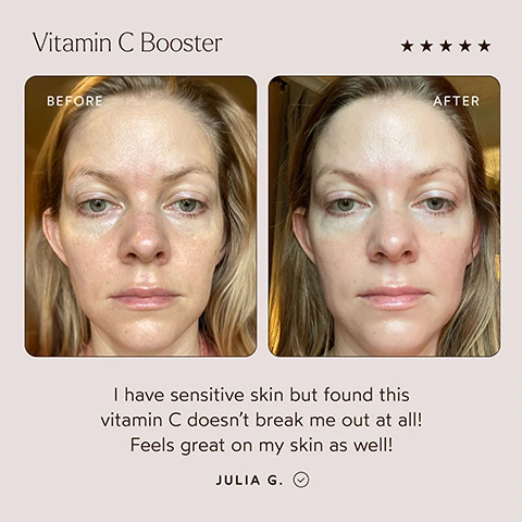 Image 1 - Image shows a split-screen comparison of a womans face before and after using Vitamin C Booster, with the left side labeled Before and the right side labeled After; there are stars for rating and text that reads I have sensitive skin but found this vitamin C doesn’t break me out at all! Feels great on my skin as well! Julia G.
Image 2 - Image shows a side-by-side comparison of a womans face labeled Before on the top and After on the bottom, demonstrating the effects of a Vitamin C booster, with visible text that reads Vitamin C Booster and the testimonial: This has definitely lightened some discolorations on my face all while lasting forever. I love adding this to my Chebula Serum, followed by the name Meg and a rating of five stars.
Image 3 - An infographic promoting a vitamin C booster for serums, featuring a beige background with a list of benefits including diminishing fine lines and wrinkles, reducing hyperpigmentation, and more, with the text Vitamin C Booster Give Your Favorite Serum a Boost of Vitamin C at the top.
Image 4 - A labeled image of a brown bottle of Vitamin C Booster from True Botanicals, surrounded by green leaves and a light gray background, includes text describing the benefits of Vitamin C as an antioxidant and Ferulic Acid for skin health.
Image 5 - An informative graphic featuring the text MADE WITH SAFE INGREDIENTS, details about products certified by MADE SAFE, and lists banned substances such as Sodium Lauryl Sulfate (SLS), Phthalates, and more, along with various certification icons.