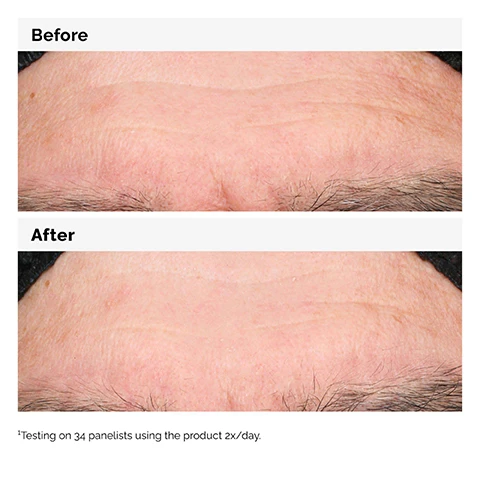 Image 1 and 2, before and after. testing on 34 panelists using the product twice a day. image 3, key ingredients in hyaluronic acid 2% + B5/ hyaluronic acid - five forms of hyaluronic acid work on different layers of the surface of the skin to hold water. ceramides - oil like molecules that combine to support the skin barrier helping to keep water in. pro vitamin b5 - works within the skin moisture barrier to help maintain it. image 4, hyaluronic acid 2% + B5 now with added ceramides. hydrates, plumps and smooths. improves the look of skin texture. skin is more elastic and supple. plumps to reduce the look of fine lines.