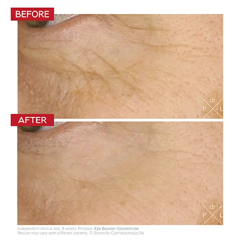Image 1, BEFORE dr P AFTER Independent clinical test, 8 weeks. Product: Eye Booster Concentrate. Results may vary with different patients. O Scientific Cosmeceuticals SA dr P L Image 2, Dr. LEVY SWITZERLAND на на на на на на на на на на нЖ нннннн INTENSE STEM CELL Eye Booster Concentrate Concentré Activateur Contour des Yeux Just as many opportunities to enhance your gaze Coulon 002 Депк