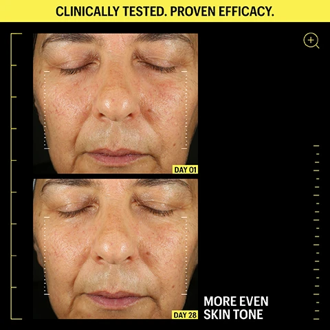 Image 2 - Two side-by-side images of a persons face with eyes closed; the top image labeled DAY 01 shows uneven skin tone with visible redness, and the bottom image labeled DAY 28 shows a more even skin tone, accompanied by the text CLINICALLY TESTED. PROVEN EFFICACY. and MORE EVEN SKIN TONE.
Image 3 - A close-up of a glossy yellow substance with text listing key ingredients including 0.05% Encapsulated Retinal, 5 Peptides, 2% Ornithine & EGCG Complex, and 7.1% Ceramide & Omegas Complex.
Image 4 - The image shows two close-up photographs of a forehead, with an emphasis on forehead lines, labeled DAY 01 and DAY 28, and includes the text CLINICALLY TESTED. PROVEN EFFICACY. and HELPS SMOOTH THE APPEARANCE OF FOREHEAD LINES.
Image 5 - A flowchart presenting guidelines for using retinol products, featuring two night cream tubes labeled Retinal 0.1% & Peptides Advanced Repair Night Cream and Retinal 0.05% & Peptides Repair Night Cream, with text instructions and decisions about starting and increasing usage based on experience with retinoids.
Image 6 - An abstract image featuring a thick, textured yellow substance with the text Retinal is 11x faster-acting and 3x more bio-active than Retinol, along with citations for scientific references.
Image 8 - Two tubes of skincare products are displayed side by side: a light beige tube labeled Peptides & Antioxidants Advanced Firming Daily Treatment and a black tube labeled Retinal 0.05% & Peptides Repair Night Cream, both from Allies of Skin, with details about their ingredients and usage instructions visible.
Image 9 - Image showing a skincare routine featuring six products arranged on a black background with white text; the header reads DAY & NIGHT FIRMING & REPAIR ROUTINE and includes steps for use, detailing cleanser, mist, serum, night cream, and sunscreen.
