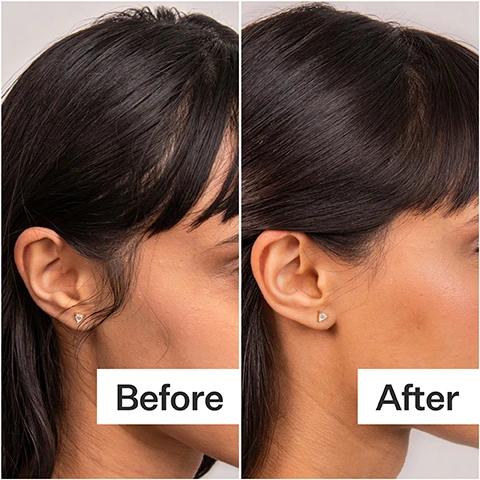 Image 1 - A woman with dark hair is shown in a side profile comparing her ear before and after wearing earrings, with Before on the left and After on the right.
Image 2 - A person holding a gray bottle of Act+Acne 4% Niacinamide Oily Scalp Serum with text on the right detailing its application and proven benefits, including stabilizes scalp to be less oily over time, extends time between washes, and prevents excess sebum production.
Image 3 - A collage of four images showing a woman with long hair on different days, labeled Day 1, Day 2, Day 3, and Day 4 in each corner respectively.
Image 4 - Three circular graphs showing statistics: 99% agree hair appears less oily, 96% agree it extends time between washes, and 98% agree scalp oil production was reduced, with the text Proven Results results from a consumer perception study with all hair and scalp types displayed below.
Image 5 - Text on a gray background listing the ingredients of Niacinamide Oily Scalp Serum, including Niacinamide (4%), Fermented Green Tea Blend (5%), and Astragalus Root Extract, along with production details like ethical labor (100%) and manufacturing method (cold processed), and packaging information indicating a glass bottle, pet plastic pipette, 85% recyclability, and certified post recycled box material.
Image 6 - A woman is shown in two side-by-side images; the left shows her with long, straight hair labeled Before, and the right shows her with long, wavy hair labeled After.
Image 7 - Image showing a dropper releasing liquid with a bar graph indicating that 97% of nutrients are retained with Cold Processed® methods and 10% with heat processing, alongside a statement about cold processing preserving active ingredients.
Image 8 - Side-by-side comparison images of a womans hairstyle showing the difference between the Before and After looks, with the text Before on the left and After on the right.