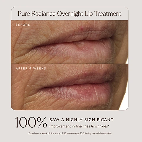 Image 1 - Image shows a comparison of two close-up photographs of lips labeled Before and After 4 Weeks with visible text stating 100% SAW A HIGHLY SIGNIFICANT improvement in fine lines & wrinkles* at the bottom.
Image 2 - A close-up of a lip treatment product labeled True Botanicals Pure Radiance Overnight Lip Treatment with a clear applicator wand, accompanied by three statistics indicating product effectiveness: 100% tested saw softer and smoother skin, 89% of participants said their lips appear less dry and flaky, and 87% of participants said their lips felt more smooth.
Image 3 - Image shows a lip product with a black tube and orange applicator in the center, surrounded by images of Arctic cloudberries, Tsubaki oil, and red raspberries, with descriptive text highlighting their benefits: Arctic Cloudberry strengthens lips, Tsubaki Oil maintains hydration, and Red Raspberry Seed Oil hydrates and firms the skin.
Image 4 - Image of a peach-colored background featuring a product label for Pure Radiance Overnight Lip Treatment with the heading Cocoon Your Lips in Hydration followed by bullet points listing benefits such as boosting moisture levels, deeply hydrating, smoothing fine lines, plumping lips, and other relevant features, along with various certification logos including PETA Approved and Vegan.
Image 5 - An infographic highlighting the MADE SAFE certification for True Botanicals products, listing banned ingredients such as Sodium Lauryl Sulfate and parabens, and emphasizing the products safety standards and eco-friendly attributes.