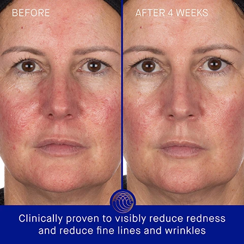 Image 3 - A split image showing the face of a person before and after using a skincare product, with the left side labeled BEFORE showing redness and skin texture issues, and the right side labeled AFTER 4 WEEKS displaying smoother skin; at the bottom, the text reads Clinically proven to visibly reduce redness and reduce fine lines and wrinkles.
Image 4 - Image shows a close-up of a facial mask and a package on a light surface, with text detailing clinically proven results: Skin hydration improved by 95%, skin luminosity improved by 42%, and crows feet fine lines reduced by 17%.
Image 5 - A close-up image of a person applying a golden facial treatment, with text stating user proven results: 90% agree skin texture looks and feels smoother, 92% agree skin feels instantly hydrated, and 78% agree skin appears firmed and lifted, along with a note about a consumer perception study.
Image 6 - Image of a skin care mask shaped like a face, with four areas labeled: TFC8® - A proprietary technology that creates the optimal environment for skin cellular renewal, Acetylated Hyaluronic Acid - Deeply hydrates and plumps, Copper Peptide - Helps support natural collagen production, firming and plumping skin, and Fermented Polysaccharide - Illuminates and helps reduce appearance of fine lines and wrinkles.
Image 7 - Image shows two steps for applying a facial mask, with a model applying an orange-gold mask and instructions: Step 1 Apply the mask to your face, starting with the top half and then the bottom. Leave on for 20 minutes. Step 2 Remove and pat in excess serum before following with your Augustinus Bader skincare routine. AB Insider Tip Use at least 2-3 times per week. Put in the fridge before use for extra cooling and de-puffing benefit.