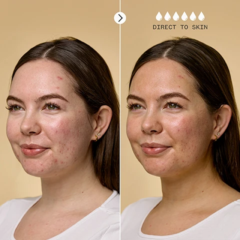 Image 1 - A woman with acne on her cheeks is smiling, with a neutral background; the right side of the image includes a graphic of water droplets and the text DIRECT TO SKIN above them.
Image 2 - A woman with a bun hairstyle is shown smiling in a side profile against a light beige background; on the right side, there is a label saying MIXED INTO MOISTURISER accompanied by three drop icons.
Image 3 - A bottle of self-tanning drops labeled The Impossible Tan by Pai is placed against a light background with three bullet points listing benefits: buildable, natural-looking tan; instantly hydrates; no streaks, irritation or breakouts, along with a green box containing the word GLOW.
Image 4 - A smiling woman with curly hair holds a brown serum bottle close to her face, with the text reading Clinically proven to hydrate for up to 8 hours, and additional icons for organic certification and vegan status in the bottom left.
Image 5 - A smiling woman with short, curly hair is facing the camera against a light beige background, with the text 92% said it caused no irritation or breakouts* and certification logos for organic and vegan standards, along with a note about a consumer trial.