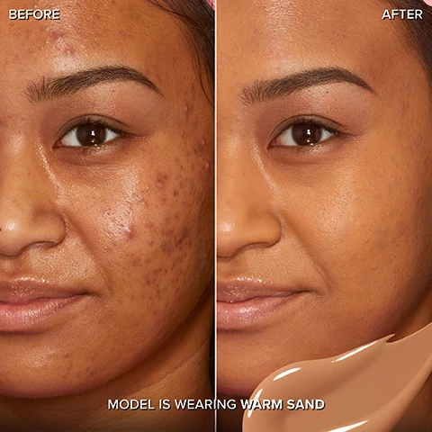Image 1 - Image shows a side-by-side comparison of a woman’s face before and after applying makeup, with visible skin imperfections on the left and a smooth complexion on the right, including the text BEFORE, AFTER, and MODEL IS WEARING WARM SAND.
Image 2 - Image of a concealer bottle labeled Too Faced Born This Way Multi-Use Sculpting Concealer Super Coverage with a black cap, against a pink background, featuring text that states OIL FREE, NON-COMEDOGENIC, 12-HOUR WEAR, NO PHOTO FLASHBACK, and CLINICALLY TESTED TO BOOST MOISTURE INSTANTLY BY 52%, with a note about clinical testing on 12 women immediately after product use.
Image 3 - An image showing two bottles of concealer, a full-size bottle on the left with a wand applicator and a travel-size bottle on the right, both labeled Born This Way MULTI-USE SCULPTING CONCEALER SUPER COVERAGE on a pink background with the text FULL SIZE and TRAVEL SIZE near each bottle.