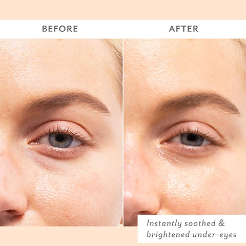 Image 1 - A close-up image shows a comparison of a womans under-eye area before and after using a skincare product, with visible improvement in brightness and smoothness; the text reads BEFORE above the left image and AFTER above the right image, along with the phrase Instantly soothed & brightened under-eyes in the bottom right corner.
Image 2 - A close-up of a womans face showing freckles and a smooth complexion, with text on the left stating INSTANTLY: Visibly calms redness, Hydrates & strengthens, De-puffs & softens.
Image 3 - A close-up image shows a light purple background with a glossy white product shaped like a crescent and droplets of liquid, alongside text that reads ECTOIN: Repairs & protects, CERAMIDES: Hydrate & strengthen, PROBIOTICS: Balance & soothe, and BOTANICAL BLEND: Brightens & softens.
Image 4 - A woman with closed eyes is applying under-eye masks while gently touching her face, with the text Instant soothing for sensitive undereyes displayed above her.
Image 5 - A woman with a smooth complexion and freckles is wearing translucent eye patches and has her eyes closed in a serene expression, with text that reads Dermatologist tested, Safe for sensitive skin, Fragrance free, and Non-irritating next to her.