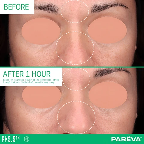 Image 1 - A before and after comparison of a persons face showing smoother skin texture, with orange blurs over the eyes and cheeks and dashed circles highlighting the forehead and nose, displays the text BEFORE, AFTER 1 HOUR, Based on clinical study of 30 consumers after 1 application. Individual results may vary, RM5.5™, and PAREVA™. Image 2 - A before and after image showing a womans face with skin improvement around the nose and cheeks, with visible text BEFORE, AFTER 1 HOUR, Based on clinical study of 30 consumers after 1 application. Individual results may vary, RM5.5™, and PAREVA™. Image 3 - A green squeeze tube product labeled PAREVA 5.5% FORMING PRIMER EN MOLECUR 3™ 5% Rice Extract + Pre-A + Hyaluronic Acid Oil Free + S&S Powders e 30 mL / 1.0 fl. oz. is centered on a light purple background with surrounding descriptive text including BIOACTIVE INGREDIENTS: 5.5%, MOLECUR 3™ Longevity superstar with exosomes and NAD+, HYALURONIC ACID Super hydrator, LECITHIN, SILICA AND SOFT-FOCUS POWDERS Oil Free Improves mattifying effect and does not cake or pill Minimizes the look of lines Eliminates makeup from settling into lines, and RICE BRAN EXTRACT ROSEMARY LEAF EXTRACT Visibly improve the appearance of pores Protects against air pollutants by forming a protective veil. Image 4 - A light green skincare tube labeled PAREVA PXG 5.5% FORMULATING PRIMER, CN CLEANER™, 2% Rice Extract, 2% Niacinamide, 0.5% Hyaluronic Acid, Silicone & Oil Free, 30ml / 1oz is at the center of a graphic with blue lines connecting it to three icons: a primer bottle labeled PRIMER, a pore minimizer bottle labeled PORE MINIMIZER, and a barrier strengthening lotion jar labeled BARRIER STRENGTHENING LOTION, illustrating the tube is 3 PRODUCTS IN 1 and 5.5% SKINCARE BIOACTIVES, with the phrase NO FUSS. JUST RESULTS. at the bottom.