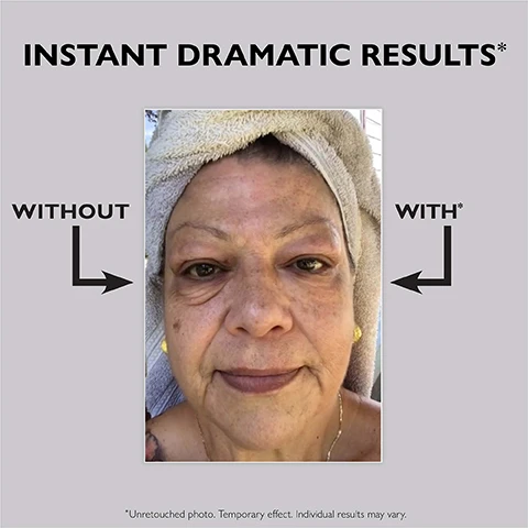 Image 2 - A close-up image of an older woman with a towel on her head and gold earrings, representing a before photo, with text that reads INSTANT DRAMATIC RESULTS* WITHOUT WITH* and a disclaimer at the bottom *Unretouched photo. Temporary effect. Individual results may vary. Image 4 - A black tube of Peter Thomas Roth Instant Firm Eye Temporary Eye Tightener rests on a white block against a blue background, with text callouts reading PETERTHOMASROTH CLINICAL SKIN CARE INSTANT FIRM® EYE TEMPORARY EYE TIGHTENER Instantly tightens firms & smoothes the appearance of crows feet fine lines & deep wrinkles around the eye area diminishes the look of under-eye puffiness for all skin types 30 ml / 1 fl oz, FIRM-A-TITE™ provides instant temporary firming, EYELISS™ helps with puffiness and wrinkles over time, and EYE REGENER® helps with under-eye bags over time. Image 5 - A black tube of Peter Thomas Roth Instant Firm Eye X Temporary Eye Tightener and a swirl of the light yellow product are displayed against a gray background with accompanying text: NO MORE UNDER-EYE BAGS, WRINKLES & CROWS FEET* BY THE NUMBERS 100% showed improvement in the look of under-eye puffiness after just 3 minutes† 3 extra-strength skin-tightening silicates and seaweed extract, and the tube itself reads PETERTHOMASROTH CLINICAL SKIN CARE INSTANT FIRM® EYE X TEMPORARY EYE TIGHTENER instantly tightens firms & smoothes the appearance of crows feet fine lines & deep wrinkles around the eye area diminishes the look of under-eye puffiness for all skin types 30 ml / 1 fl oz, followed by fine print *Temporary effect. Individual results may vary. †Based on a clinically measured study on 25 women ranging in age from 36 to 65. Image 6 - A hand with a pea-sized amount of light-colored product on a fingertip illustrates application instructions: Apply a tiny amount (the size of a grain of rice!) under each eye*, Gently spread using upward strokes, *Use the recommended amount of product to reduce the possibility of white residue. Image 7 - A black tube of Peter Thomas Roth Clinical Skin Care Instant FirmX Eye Temporary Eye Tightener, 30 ml / 1 fl oz, with text describing its benefits: instantly tightens, firms & smoothes the appearance of crows feet, fine lines & deep wrinkles around the eye area, diminishes the look of under-eye puffiness for all skin types, is shown next to five step-by-step instructions titled HOW TO USE FOR BEST RESULTS: STEP 1 Cleanse and exfoliate skin. Do not use eye cream. STEP 2 Shake tube. Dispense a grain-of-rice amount on top of the hand. STEP 3 Pick up product with your finger or brush. Apply a thin layer to completely dry skin. STEP 4 Wait 3 to 7 minutes for product to dry and stay expressionless. STEP 5 Gently pat away any residue using a wet cotton swab. Image 8 - This image is an informational graphic titled Your FAQs... Answered! providing instructions for Peter Thomas Roth Instant FIRMx Eye application, showing questions and answers including Q: Where in my routine should I apply Instant FIRMx Eye? Use after cleansing and exfoliating. Pat skin dry before applying. Q: Can I use eye cream? Youll see the best results without eye cream. If you do wear eye cream, allow it to fully absorb and dry before applying Instant FIRMx Eye. Q: Can I use concealer? Yes, concealer is okay! TIP: To avoid disrupting the instant tightening effects, choose an oil-based or powder formula and wait until Instant FIRMx Eye has completely dried before applying., alongside two black tubes labeled PETERTHOMASROTH CLINICAL SKIN CARE INSTANT FIRMx EYE TEMPORARY EYE TIGHTENER which states it instantly tightens firms & smoothes the appearance of crows feet fine lines & deep wrinkles around the eye area diminishes the look of under-eye puffiness for all skin types and contains 30 ml / 1 fl oz.