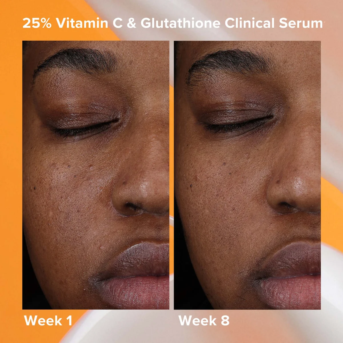 Paula's Choice 25% Vitamin C+ Glutathione Clinical Serum 30ml | Cult Beauty Paula's Choice 25% Vitamin C+ Glutathione Clinical Serum 30ml | Cult Beauty
